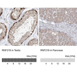 RNF219 Antibody, Novus Biologicals:Antibodies:Primary Antibodies